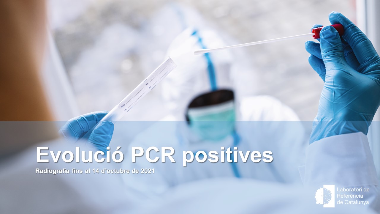 Actualitzem la situació de la xarxa: volum de PCR i positius per edat 