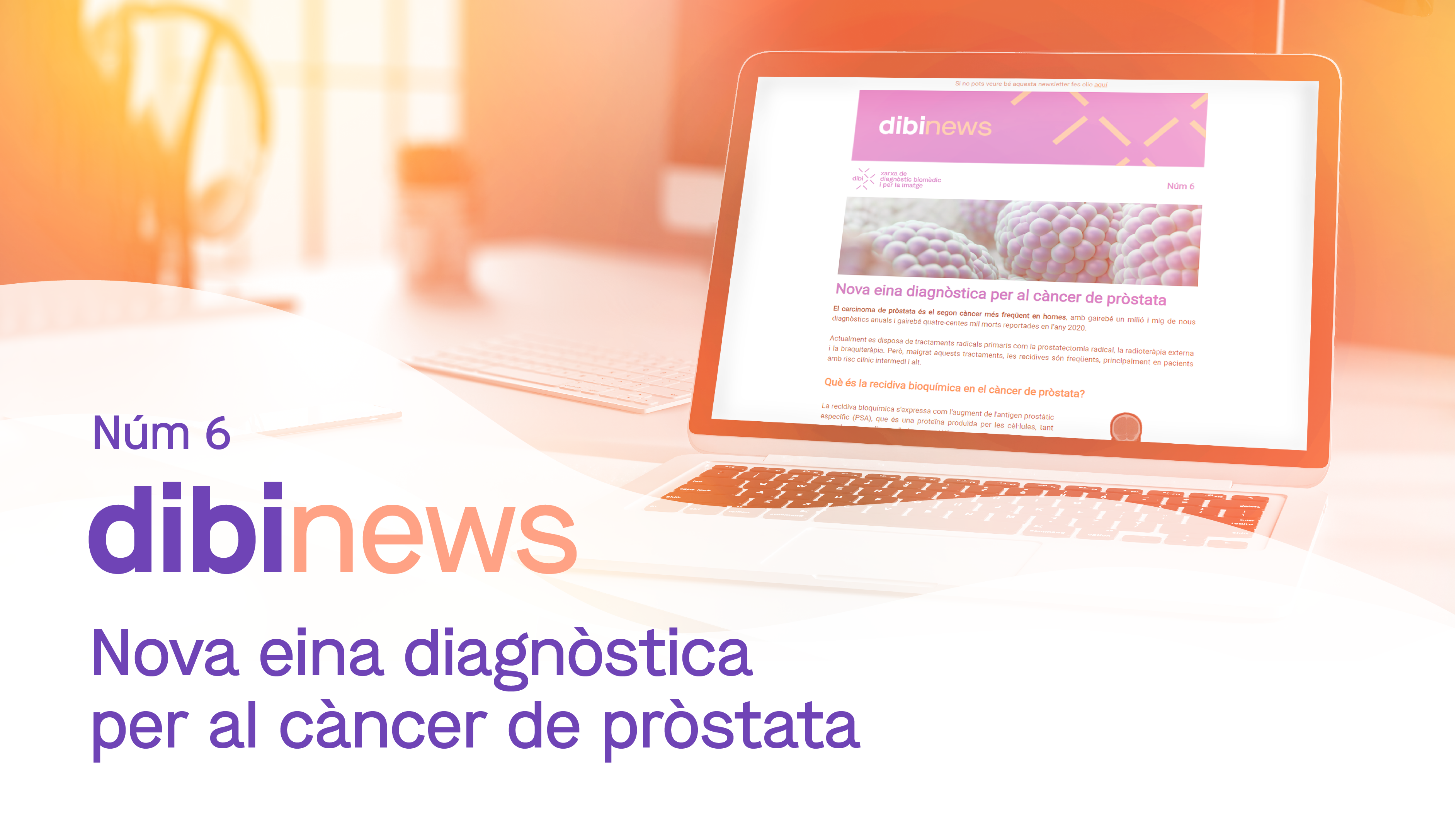 dibinews núm. 6 · Nova eina diagnòstica per al càncer de pròstata