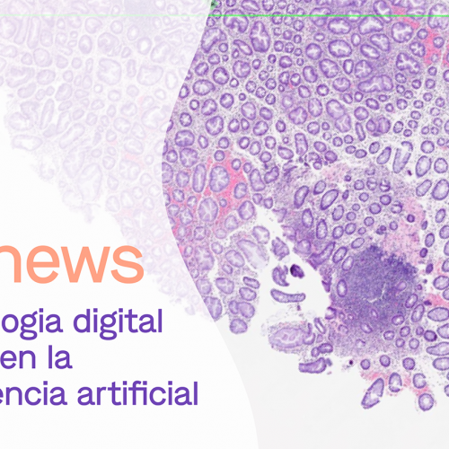 dibinews núm. 7 · La patologia digital basada en la intel·ligència artificial