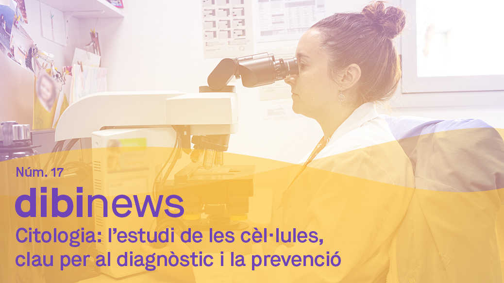 dibinews núm. 17 · Citologia: l’estudi de les cèl·lules, clau per al diagnòstic i la prevenció